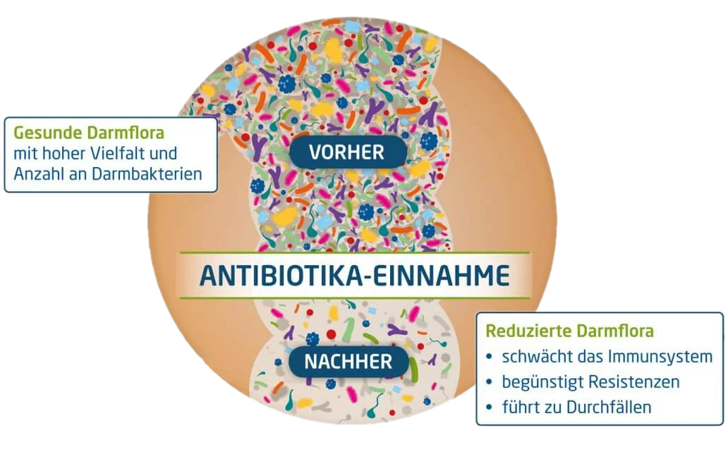 Schematische Darstellung: Darmflora vor und nach Einnahme von Antibiotika Schematische Darstellung: Darmflora vor und nach Einnahme von Antibiotika